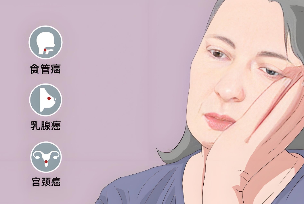癌症