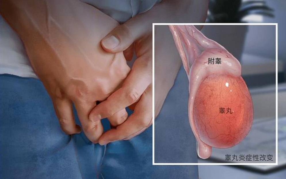 生殖系统检查