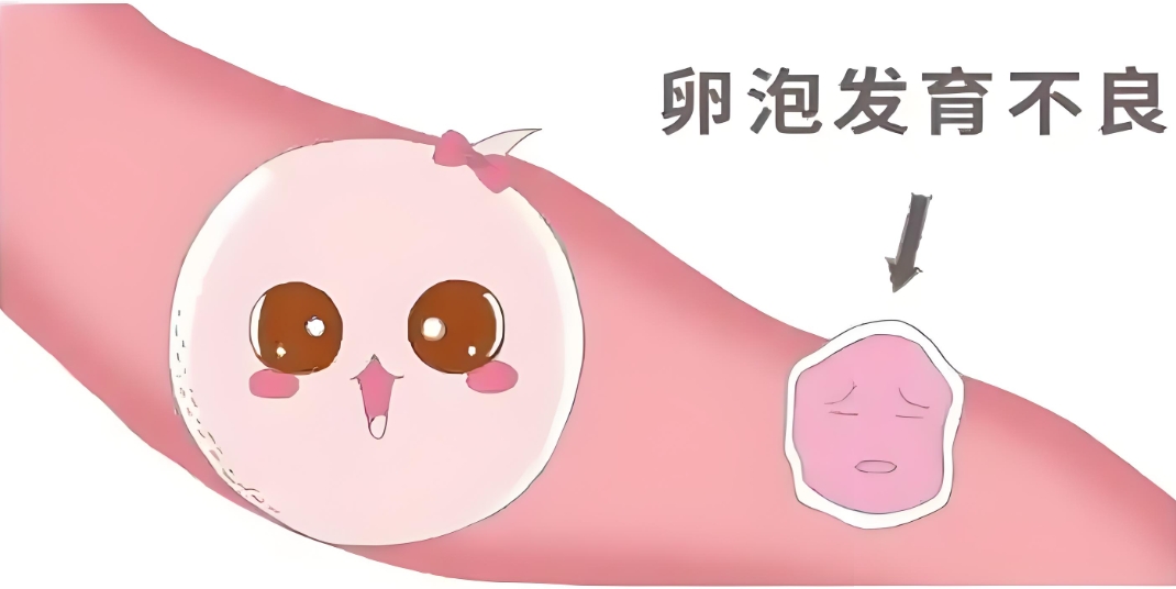 不良卵泡