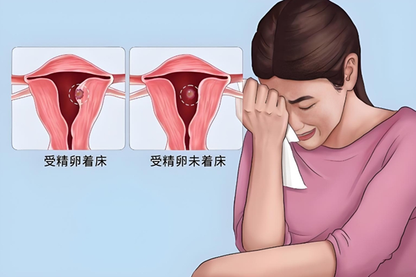 生化妊娠