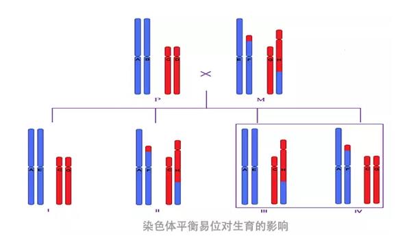 染色体平衡易位