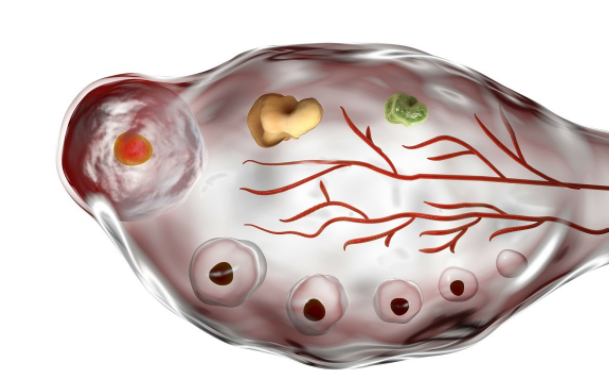 卵巢卵泡