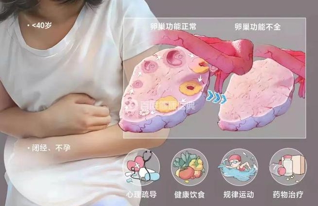 卵巢功能异常