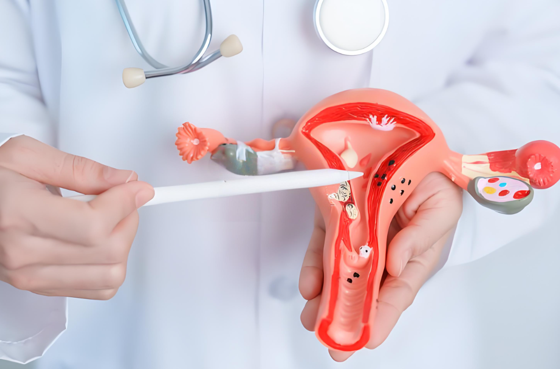 女性子宫肌瘤问题