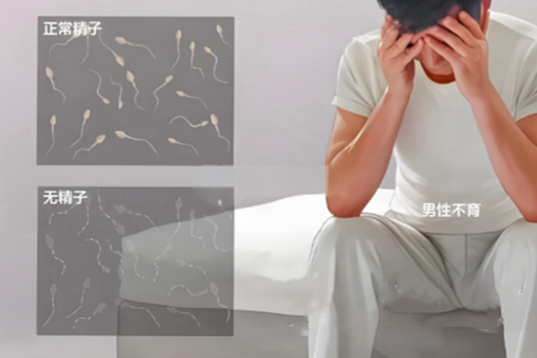 男性不育
