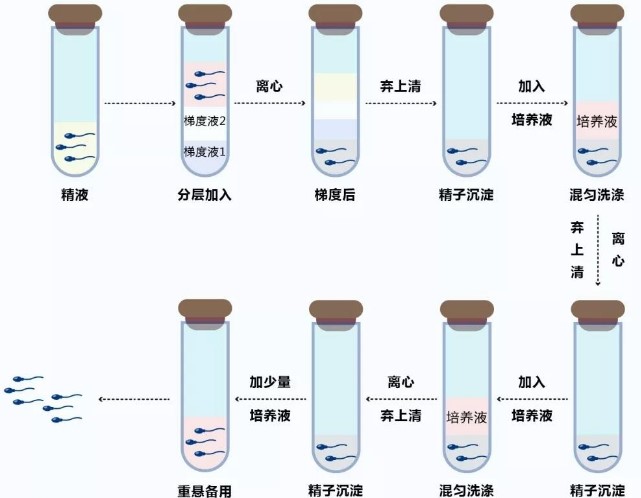 梯度离心