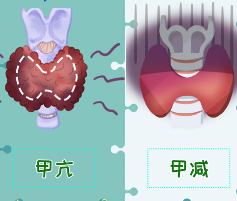 甲亢、甲减