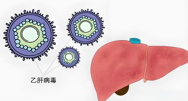 乙肝病毒