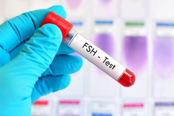 FSH